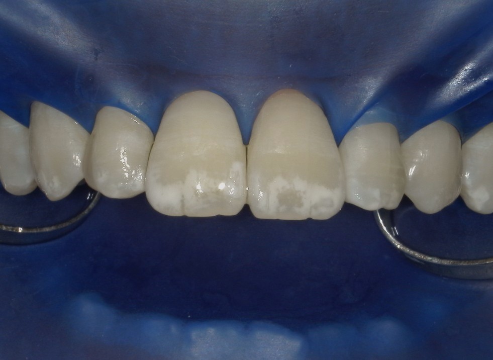 Before image